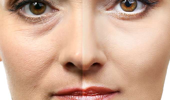 Innovations in Fat Grafting