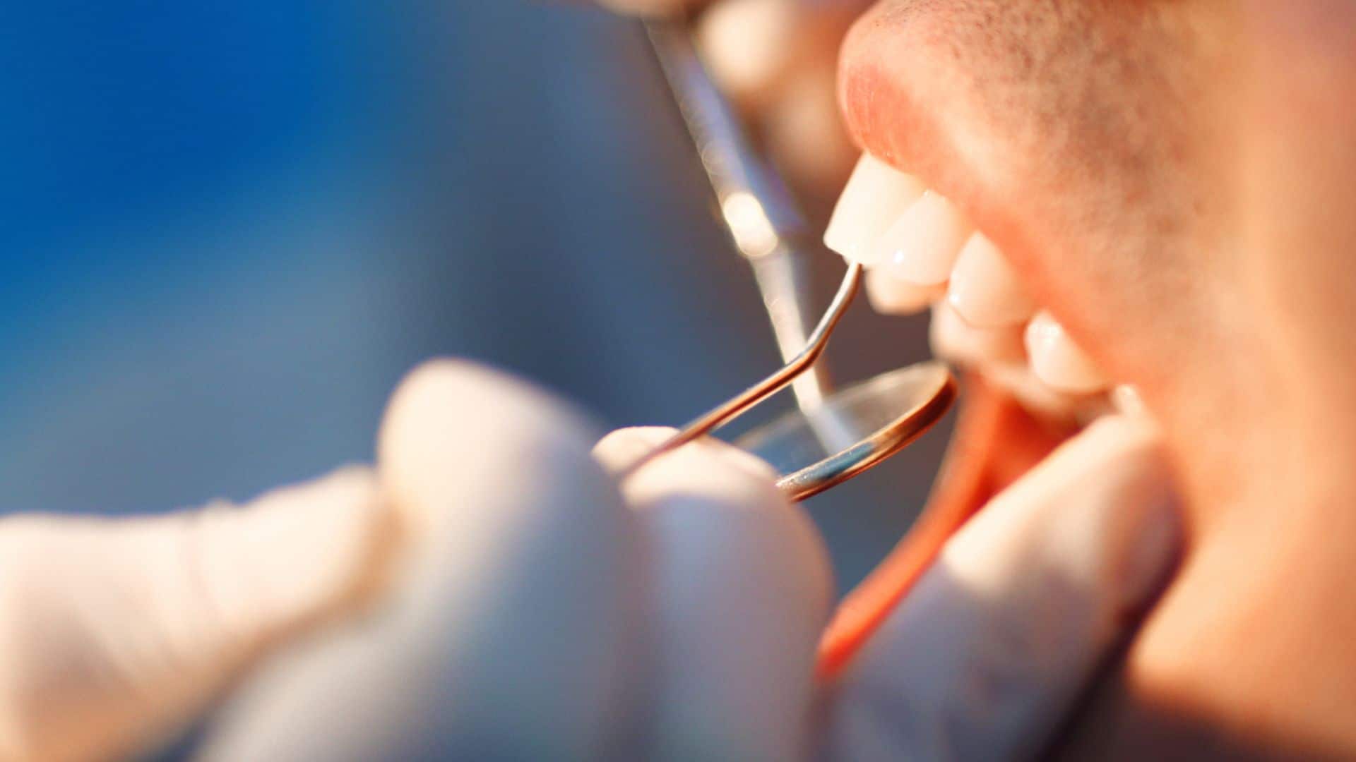 The Role of Urgent Dental Care in Managing Tooth Emergencies